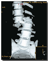 Just some minor stiffness